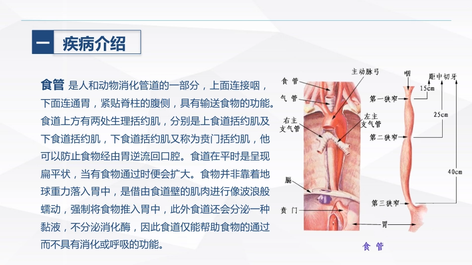食管癌的护理_第3页