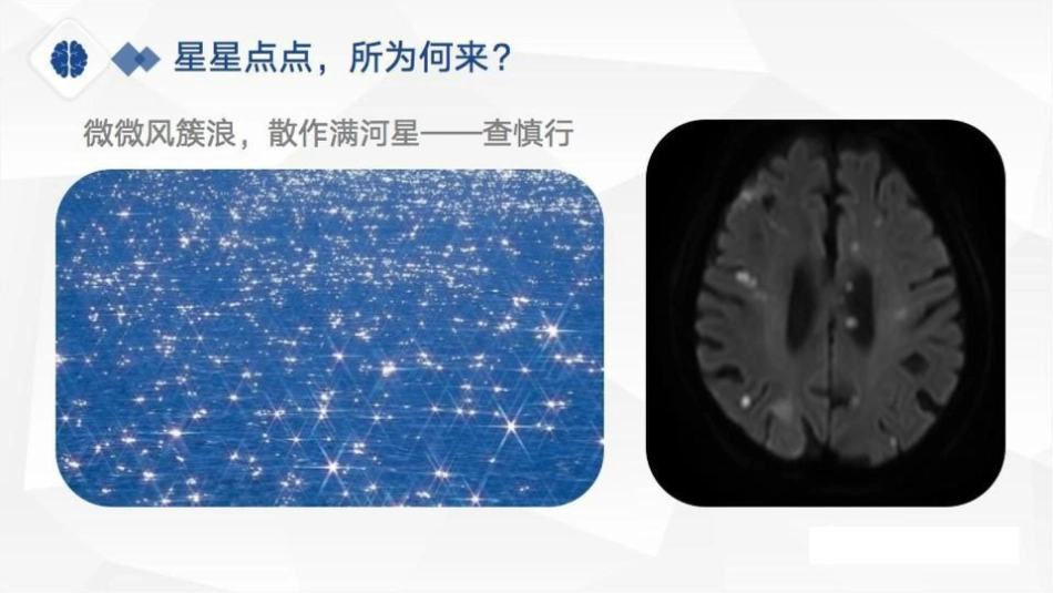 特鲁索综合征病理分享、病因及鉴别诊断_第2页