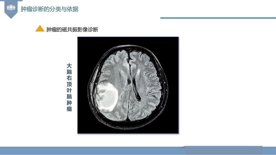 肿瘤的诊断与T-N-M分期_第14页