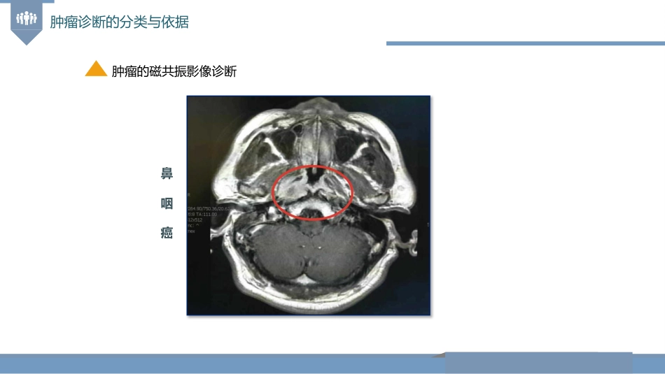 肿瘤的诊断与T-N-M分期_第15页