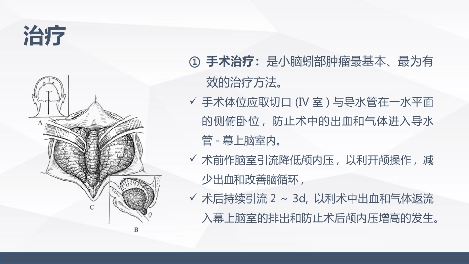 小脑蚓部占位的业务学习_第11页