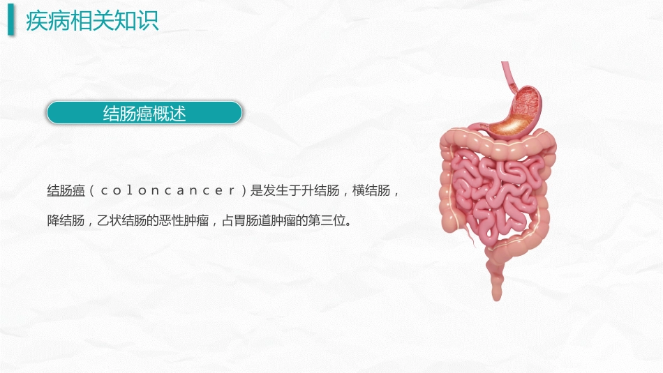 结肠癌护理查房_第4页