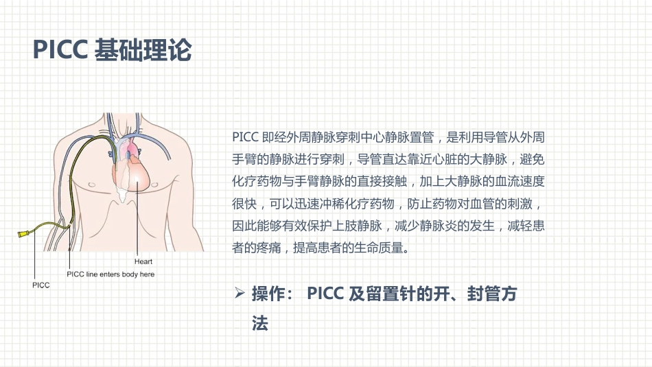 肿瘤科护理小讲课：第二周_第13页