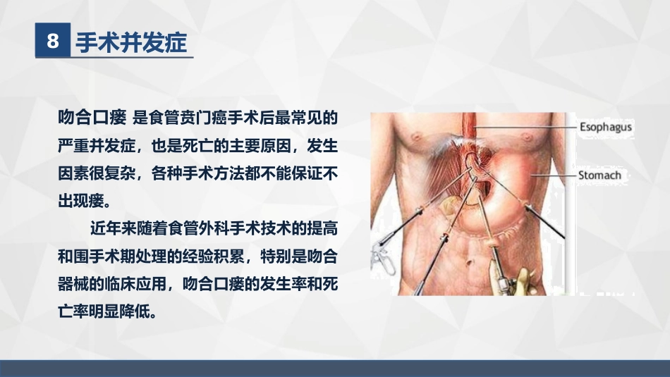 普外科-贲门癌伴脓胸吻合口瘘护理查房_第12页