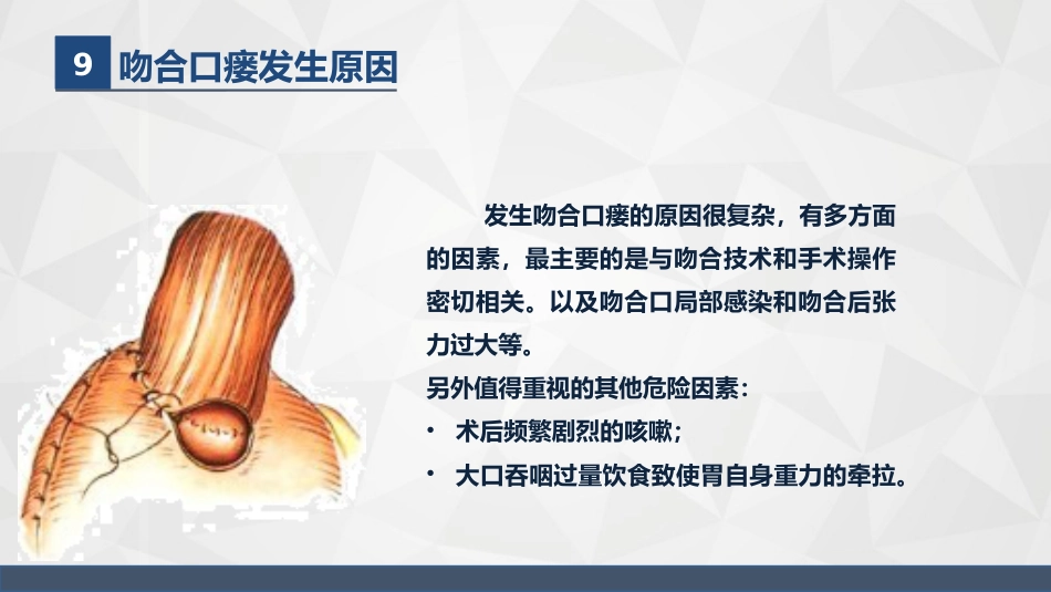 普外科-贲门癌伴脓胸吻合口瘘护理查房_第13页