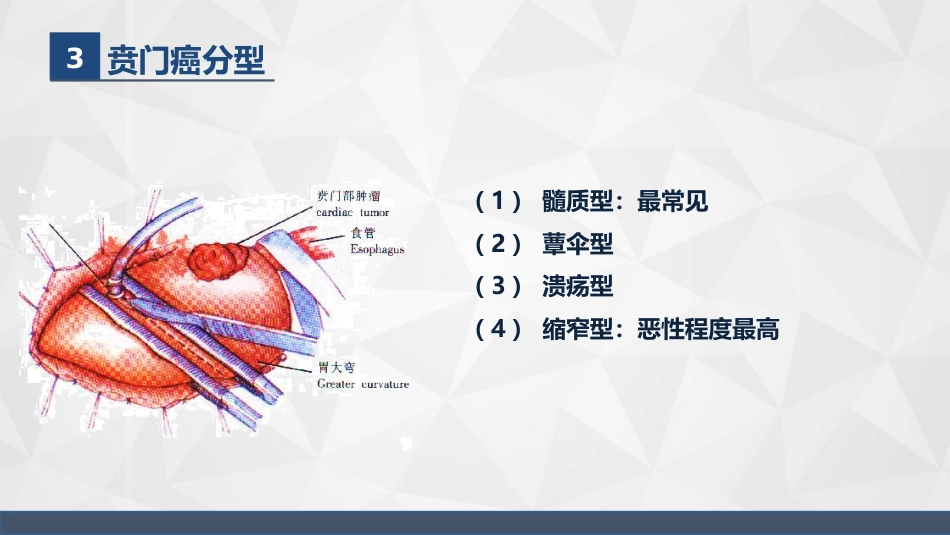 普外科-贲门癌伴脓胸吻合口瘘护理查房_第6页