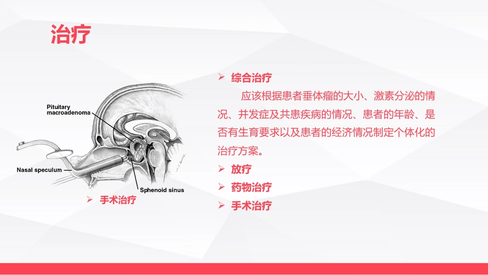 垂体瘤病人护理_第10页