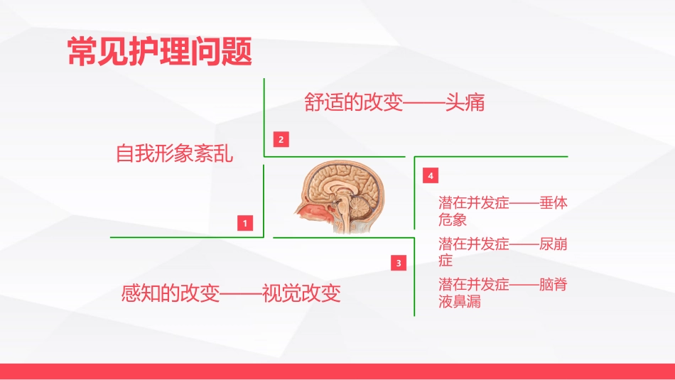 垂体瘤病人护理_第12页