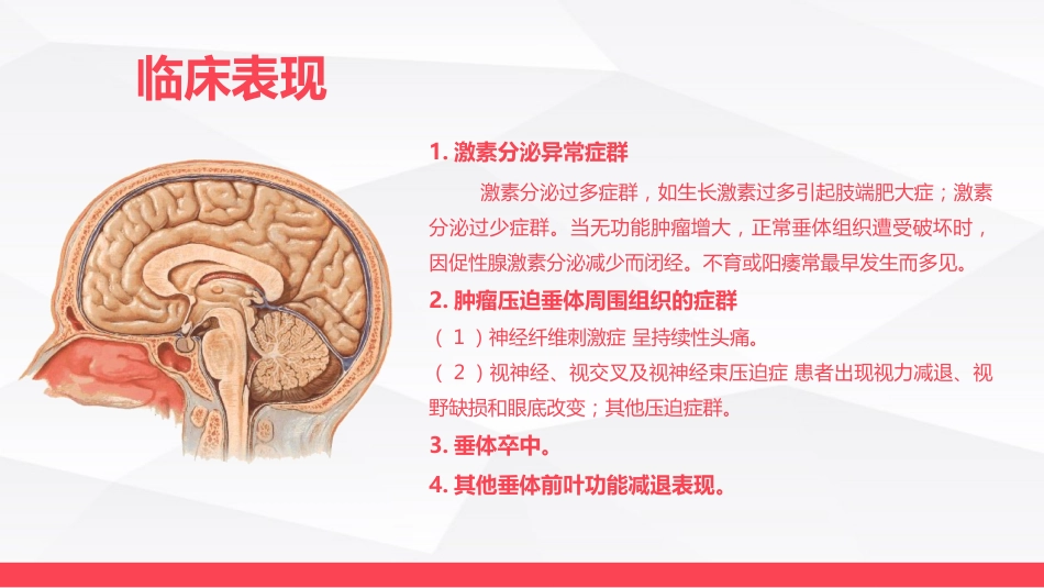 垂体瘤病人护理_第6页