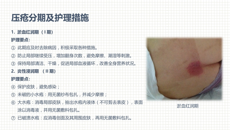 肿瘤科护理小讲课：第四周_第2页