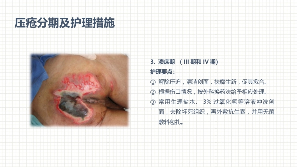 肿瘤科护理小讲课：第四周_第3页