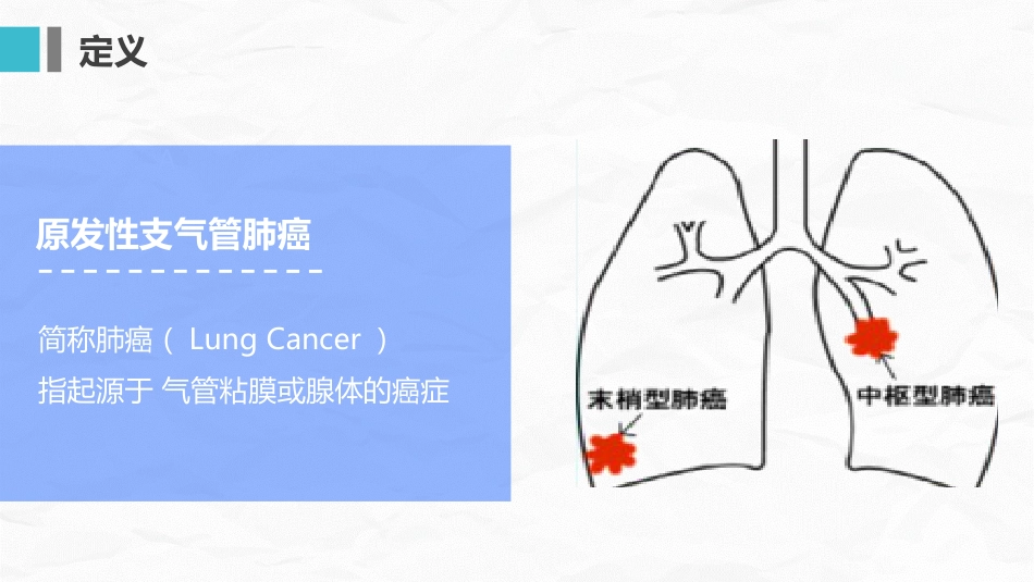 肺癌护理查房_第3页