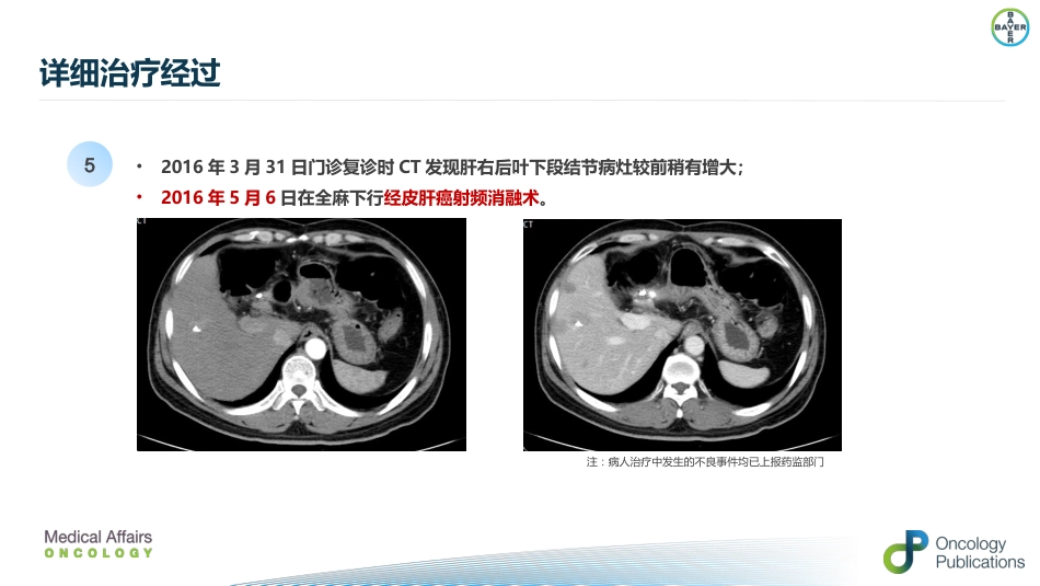 肝癌二线治疗瑞戈非尼_第8页