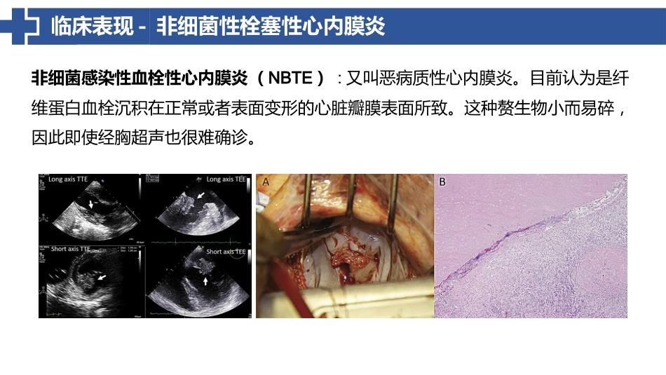 特鲁索综合征_第10页