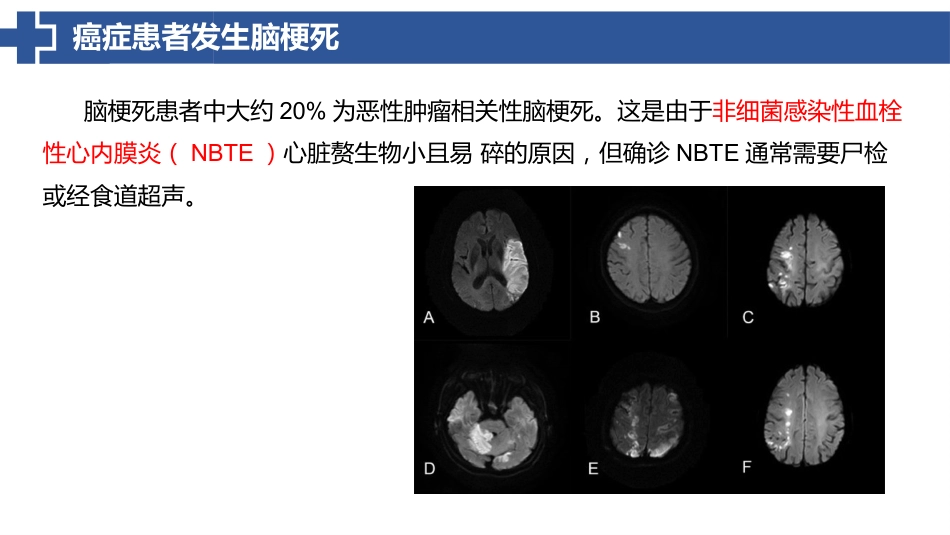 特鲁索综合征_第15页