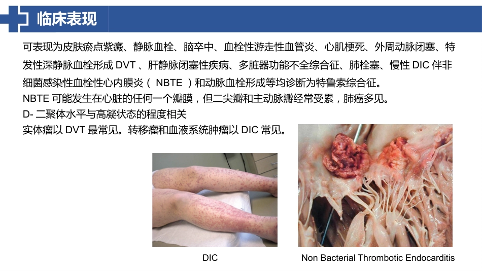 特鲁索综合征_第7页
