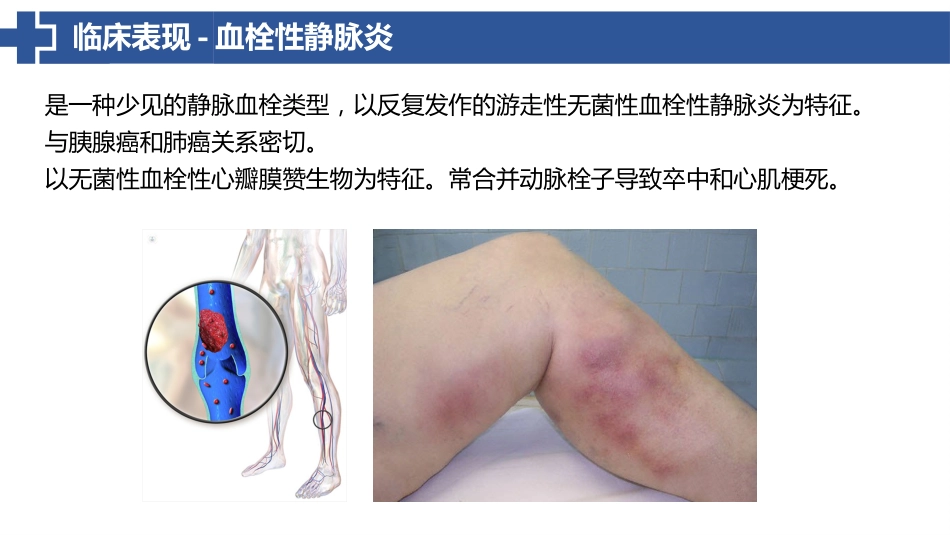 特鲁索综合征_第9页