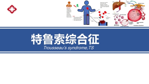 特鲁索综合征