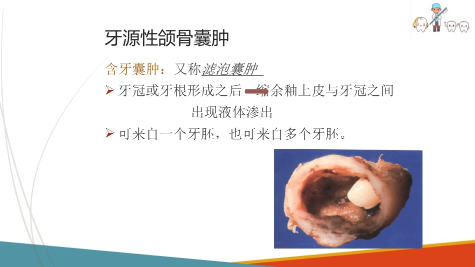 口腔颌面部肿瘤—口腔颌面部颌骨囊肿_第12页