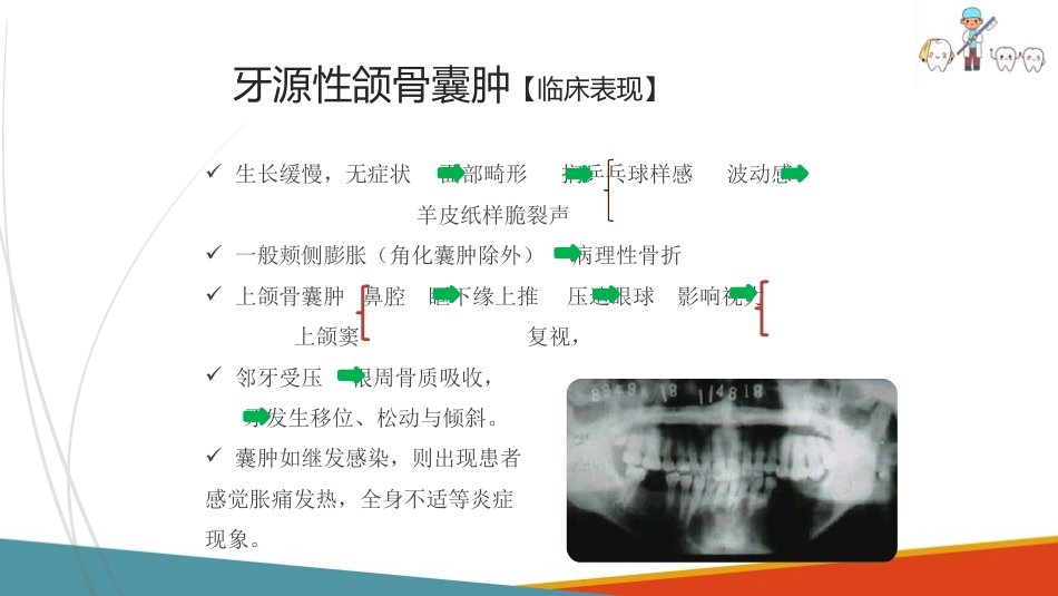 口腔颌面部肿瘤—口腔颌面部颌骨囊肿_第15页