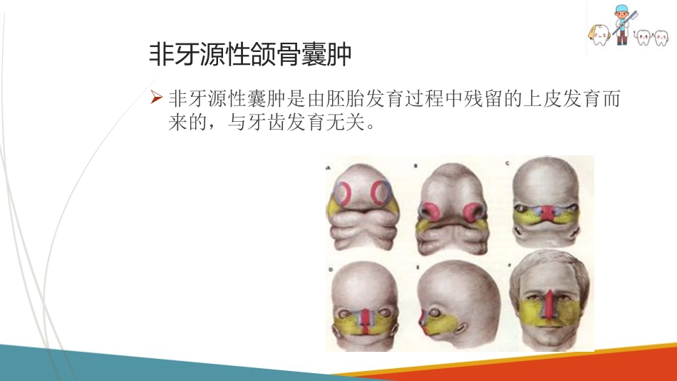口腔颌面部肿瘤—口腔颌面部颌骨囊肿_第3页