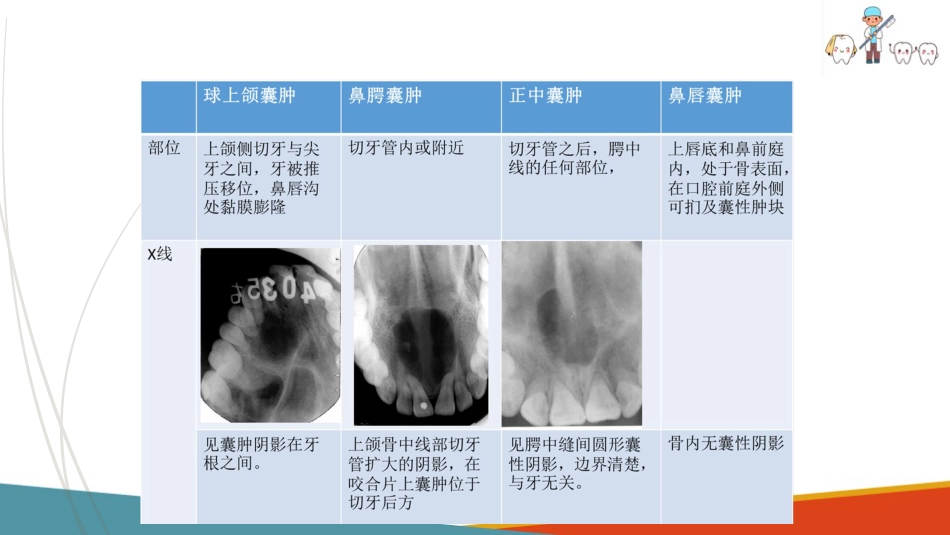 口腔颌面部肿瘤—口腔颌面部颌骨囊肿_第5页