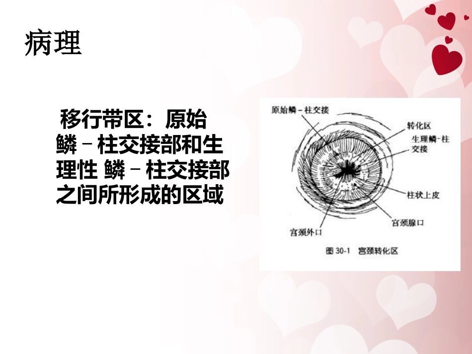 宫颈癌护理查房 (1)_第14页