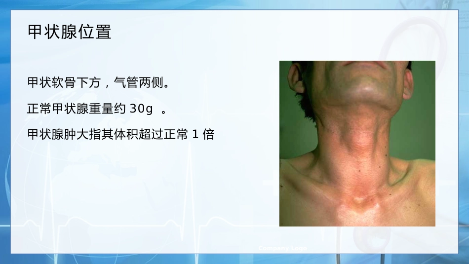 甲状腺癌的护理查房1_第8页