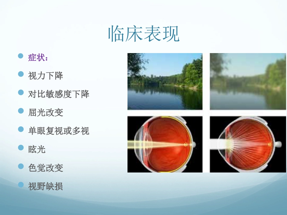 白内障_第5页