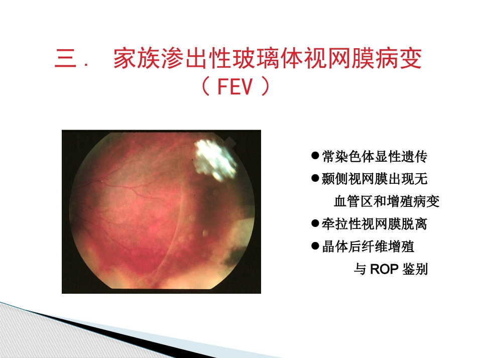 玻璃体病,视网膜病 PPT_第11页
