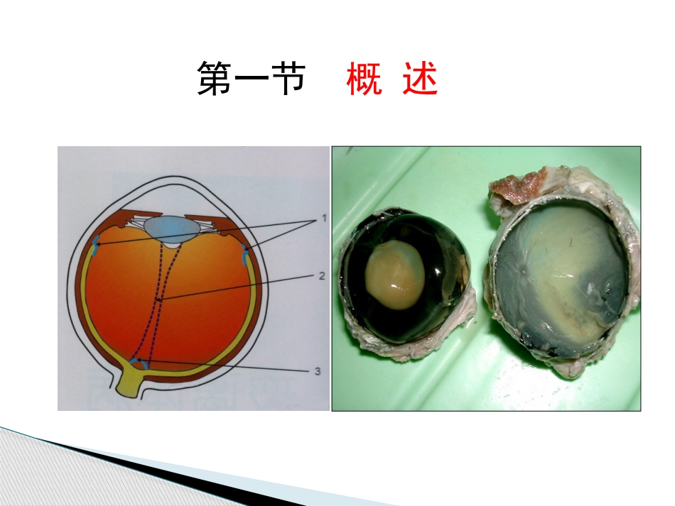 玻璃体病,视网膜病 PPT_第2页