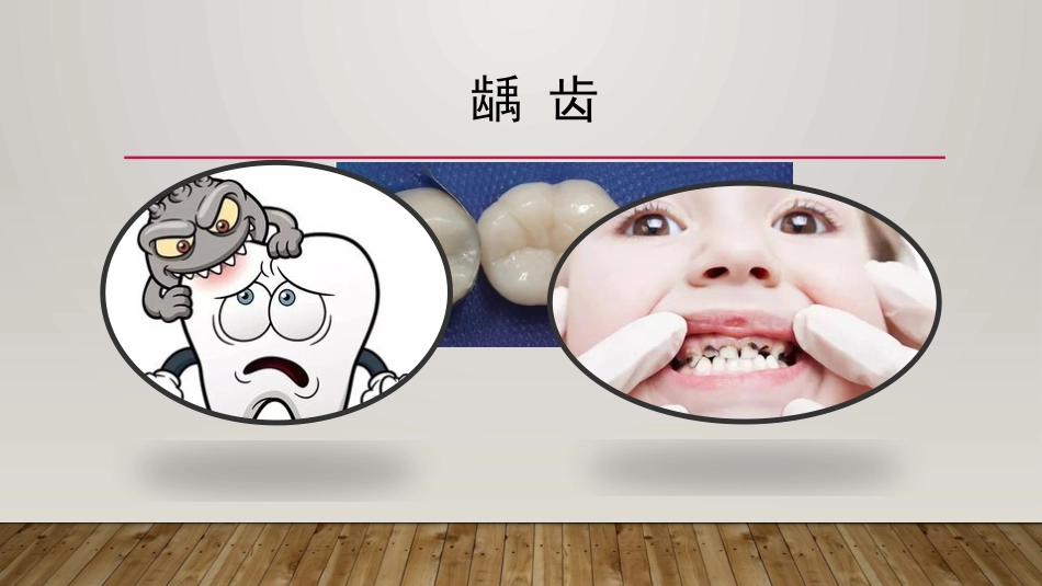 儿童近视龋齿肥胖_第6页