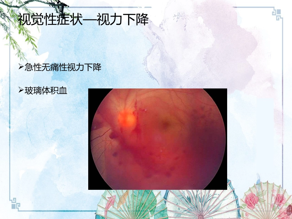 【眼科学基础】眼科症状学_第14页