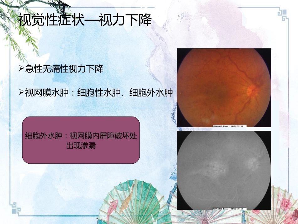 【眼科学基础】眼科症状学_第9页