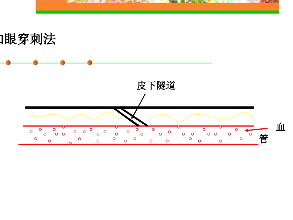 钝针扣眼法在临床中的应用ppt_第9页