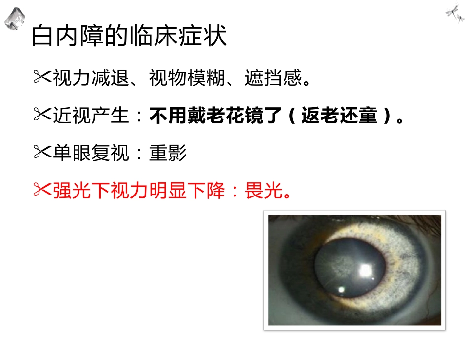 常见的眼科疾病科普_第12页