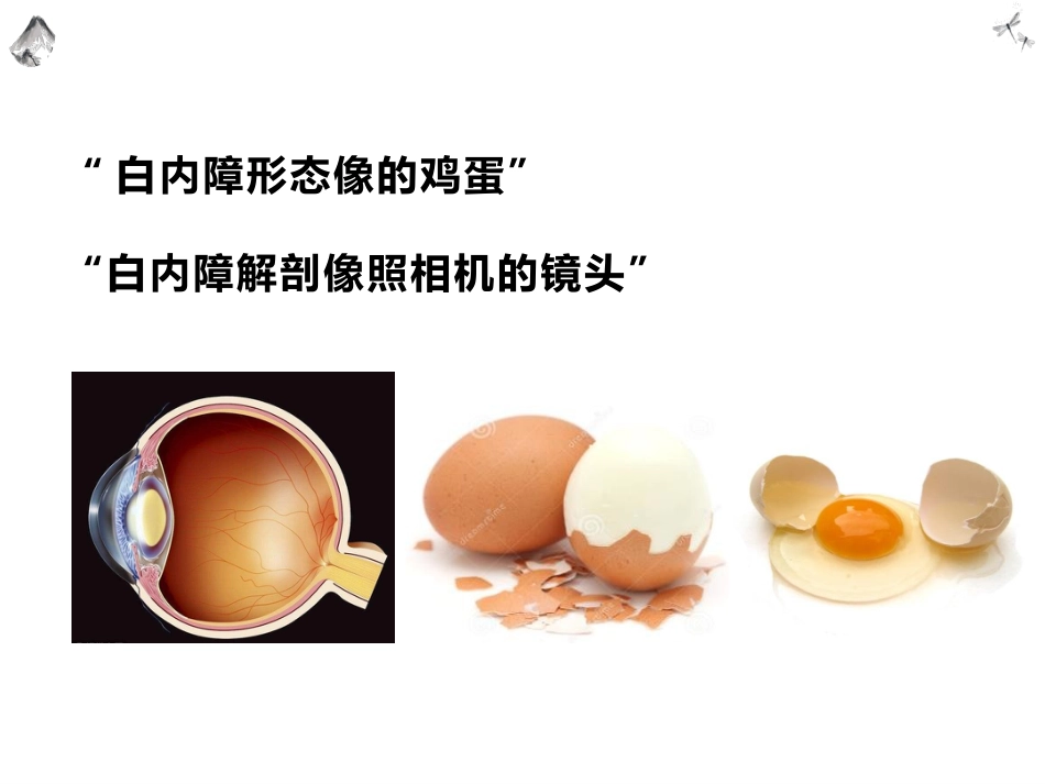 常见的眼科疾病科普_第15页