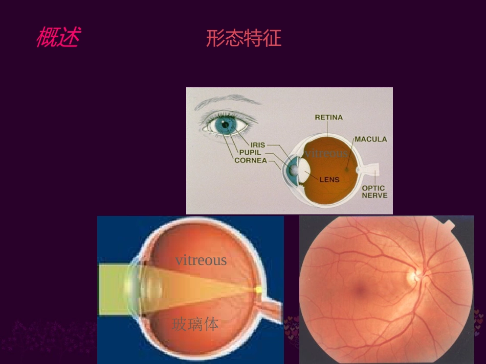 玻璃体病 _第3页