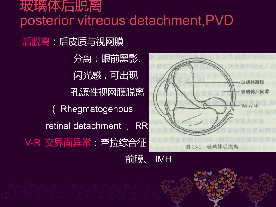 玻璃体病 _第8页