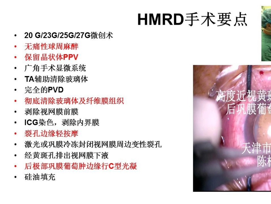 病理近视后巩膜葡萄肿合并黄斑裂孔视网膜脱离_第10页