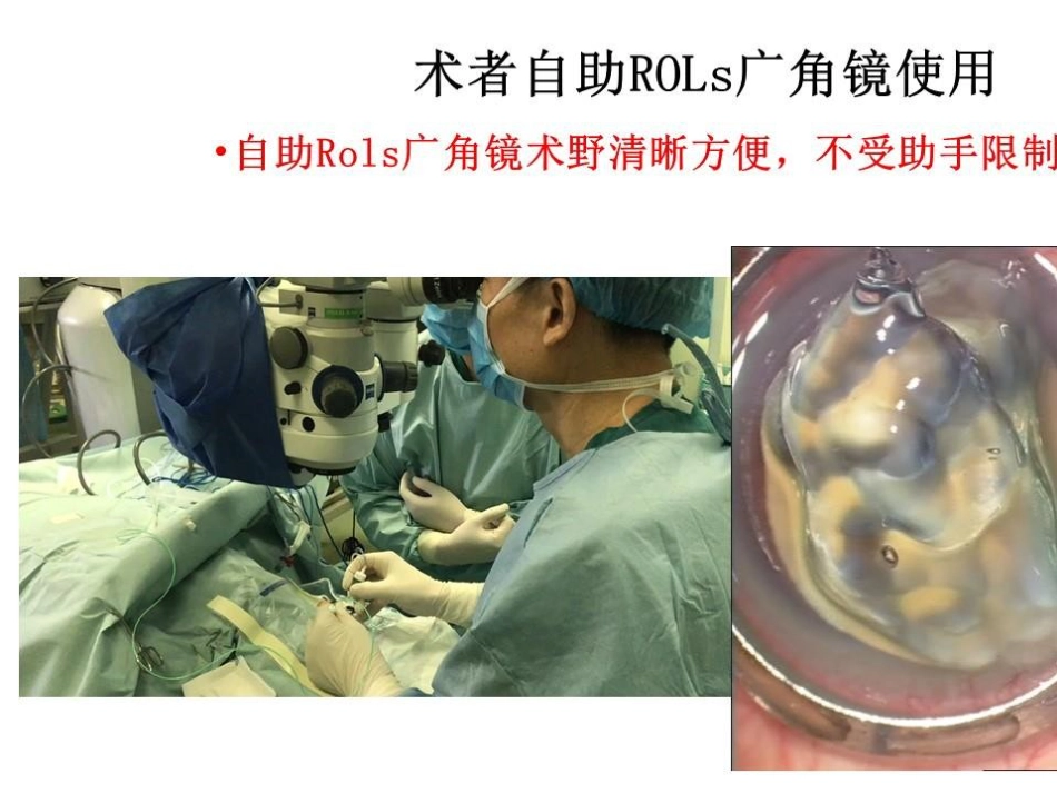 病理近视后巩膜葡萄肿合并黄斑裂孔视网膜脱离_第11页