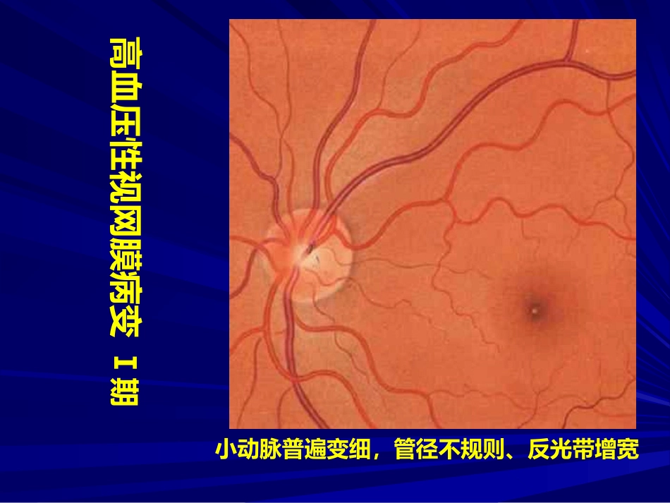 常见全身病的眼部表现_第13页