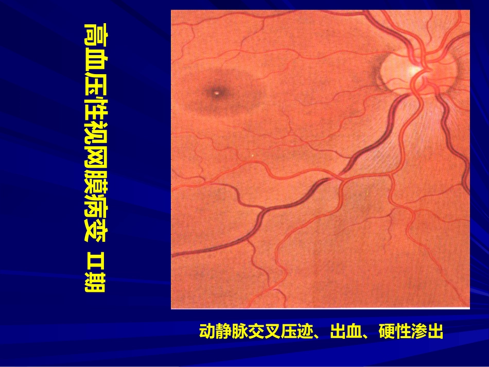 常见全身病的眼部表现_第14页