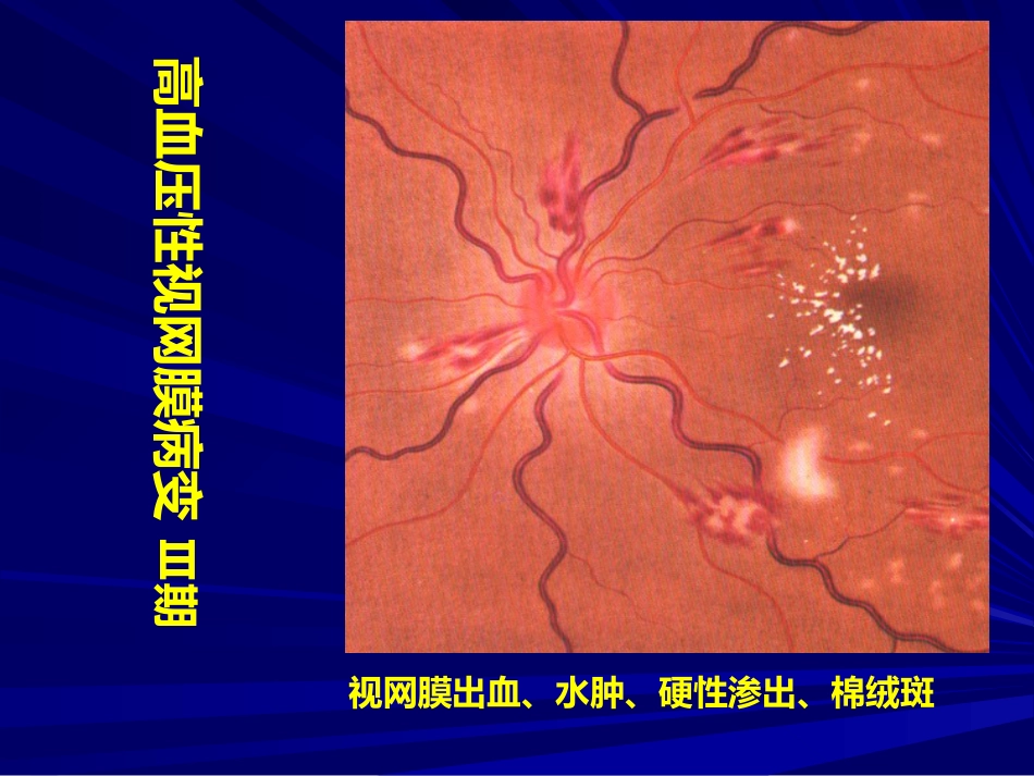 常见全身病的眼部表现_第15页