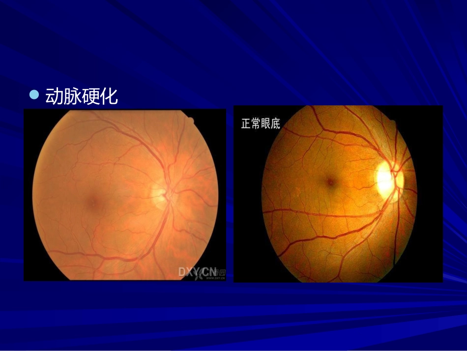 常见全身病的眼部表现_第6页