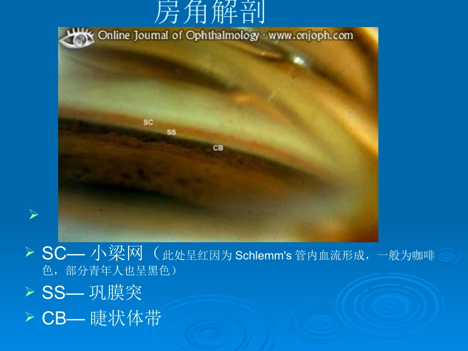 闭角型青光眼_第11页