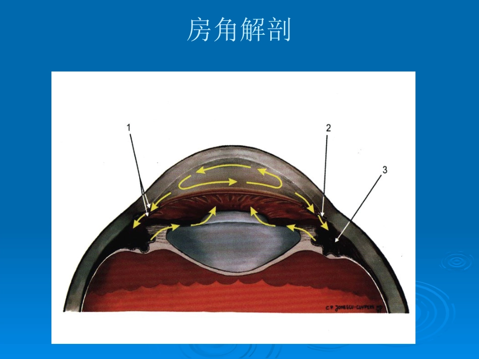 闭角型青光眼_第3页