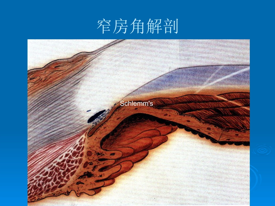 闭角型青光眼_第4页