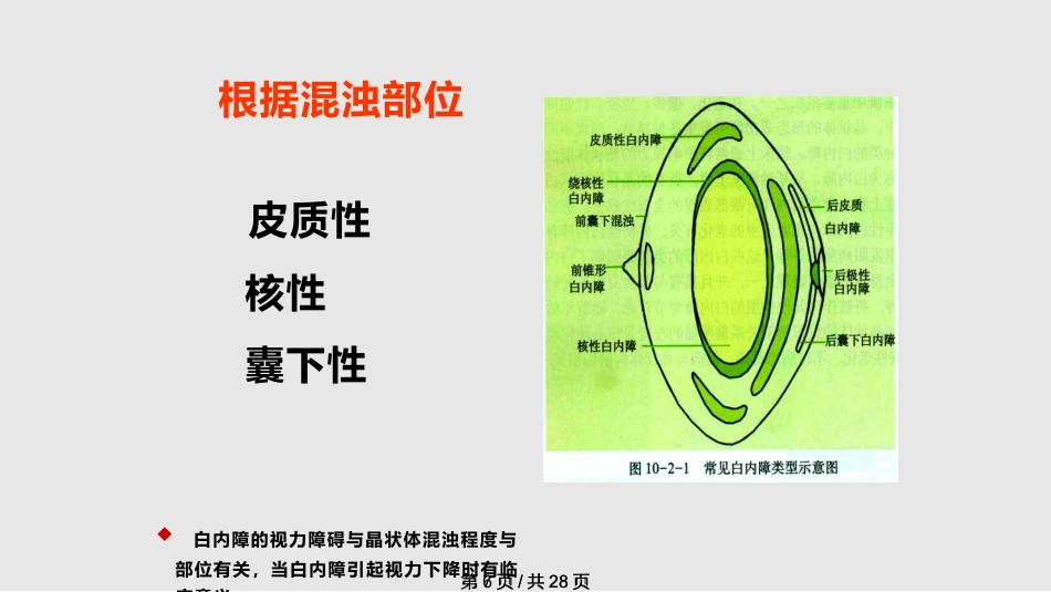 白内障概述_第7页
