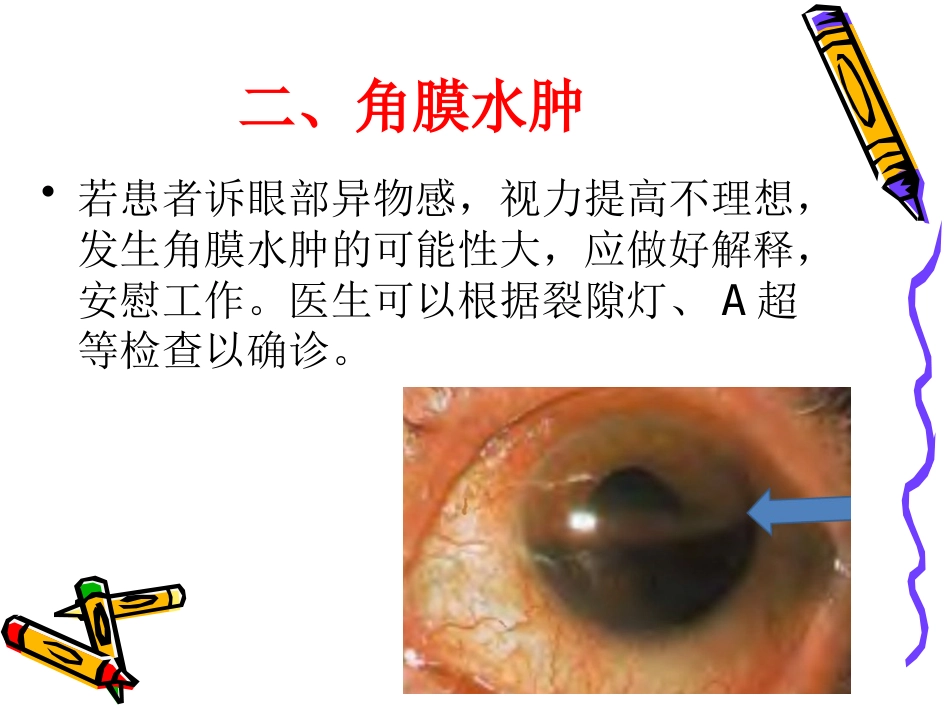 白内障术后并发症及注意事项_第4页